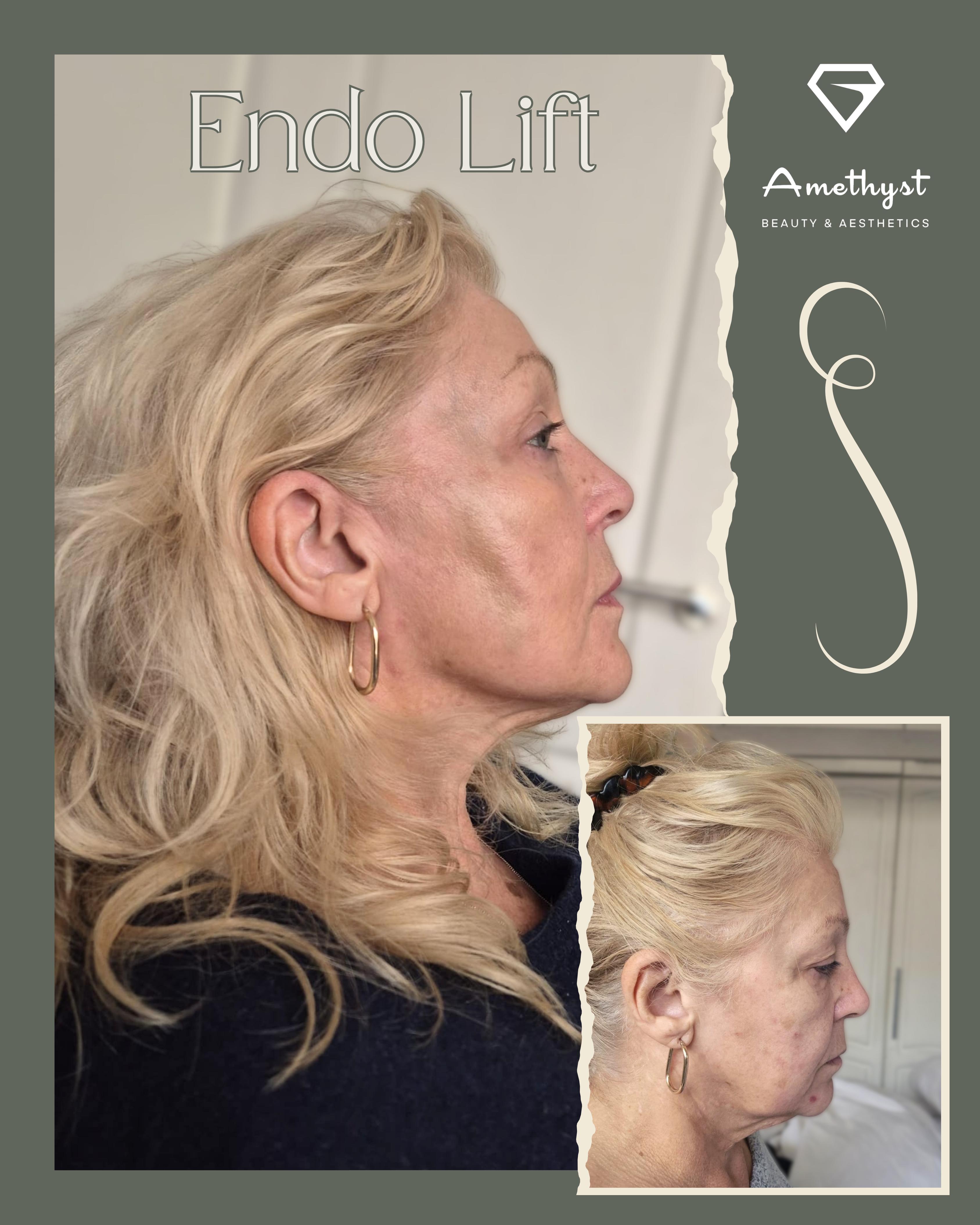 Profile View Results