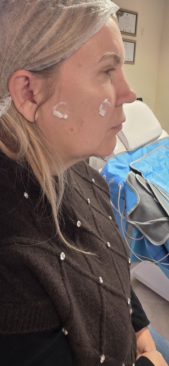 Right Side Profile - Before